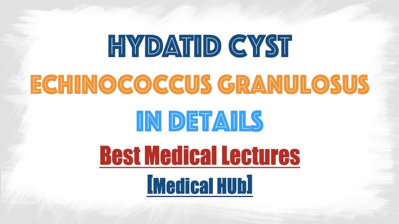 Hydatid cyst of Echinococcus granulosus(Dog tapeworm) : Discussed in details everything you need